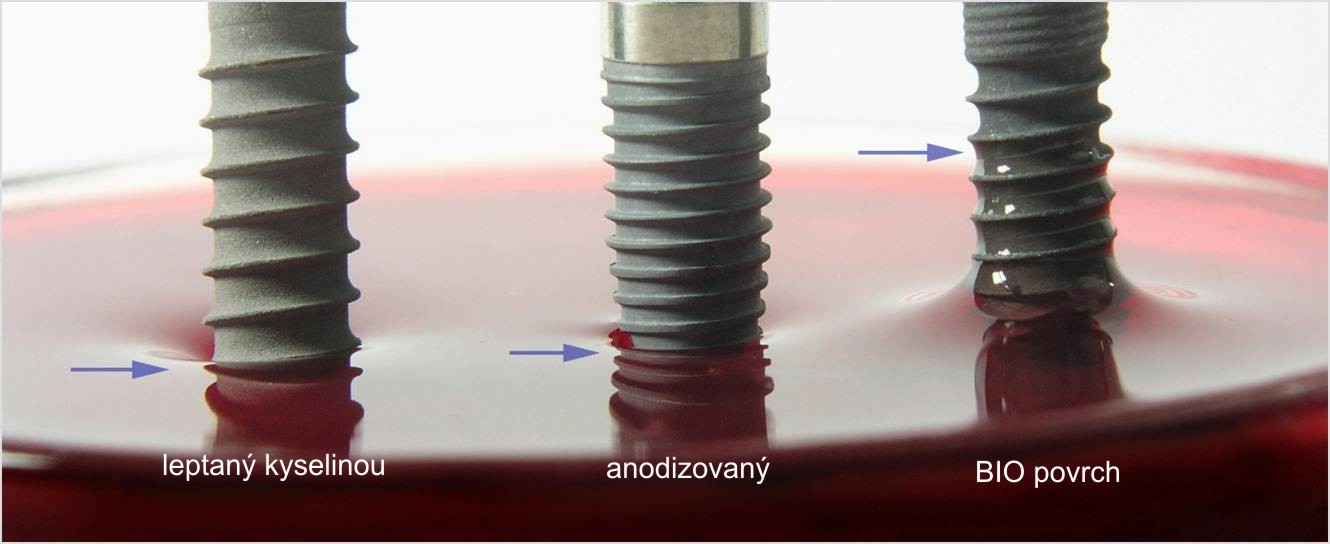 Detail struktury BIO povrchu dentálního implantátu LASAK
